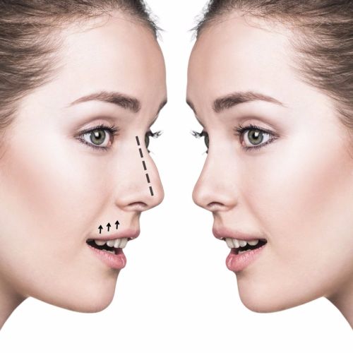 14 неща, които формата на носа казва за характера